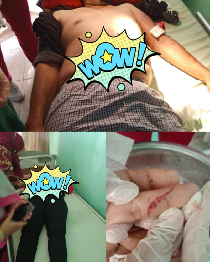 Tragis!! Suami Meregang Nyawa, Istri Alami 3 Luka Tusuk