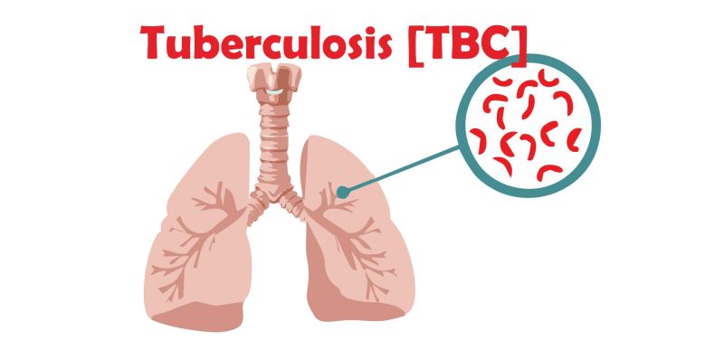 Ilustrasi TBC