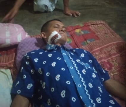 Kasus pembacokan terhadap Teguh Zainal, wartawan salah satu media online yang bertugas di Kecamatan Gelumbang, Kabupaten Muara Enim menuai sorotan tajam dari Persatuan Wartawan Indonesia [PWI].