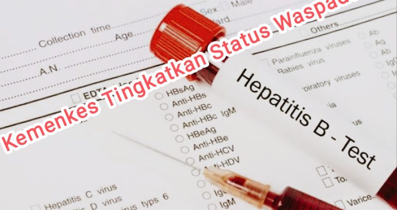 Ilustrasi Hepatitis