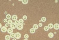 Jamur Cryptococcus neoformans. (Foto: Centers for Disease Control and Prevention)