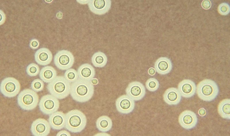 Jamur Cryptococcus neoformans. (Foto: Centers for Disease Control and Prevention)