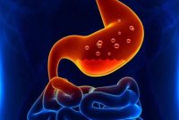 Ilustrasi lambung sakit maag. (Foto: doktersehat.com)