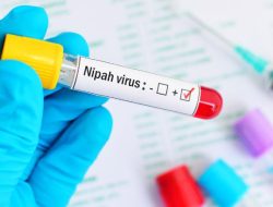 Bahaya Virus Nipah dan Potensinya Menjadi Pandemi Baru