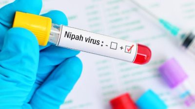 Bahaya Virus Nipah dan Potensinya Menjadi Pandemi Baru