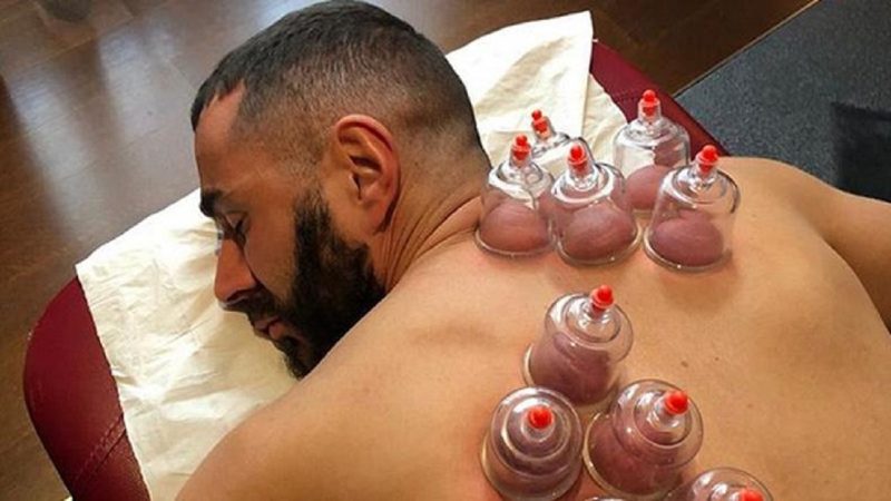 Foto: ilustrasi seseorang melakukan bekam (sumber foto: Kemenkes RI)