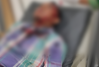 Ketua Kelompok Penyelenggara Pemungutan Suara [KPPS] Osa [30] mengalami luka bacok di bagian kepala, Kelurahan 30 Ilir Kecamatan Ilir Barat [IB] II, mendapat perawatan di Rumah Sakit AK Gani Palembang.