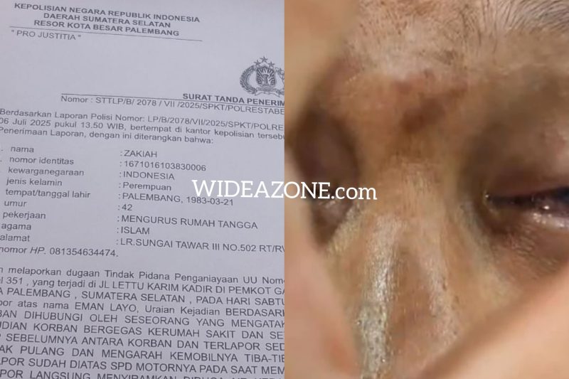Warga 29 Ilir, lorong Sungai Tawar, Palembang, M Junaidi alias Mamat [40] nyaris mengalami kebutaan usai diduga terdampak penyiraman air keras oleh teman lamanya sendiri.
